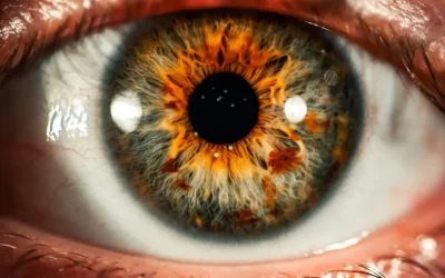 Pupilas dilatadas, ¿a qué se debe la midriasis?