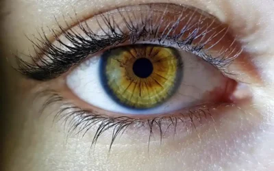 Orzuelo en el ojo: Causas y tratamiento