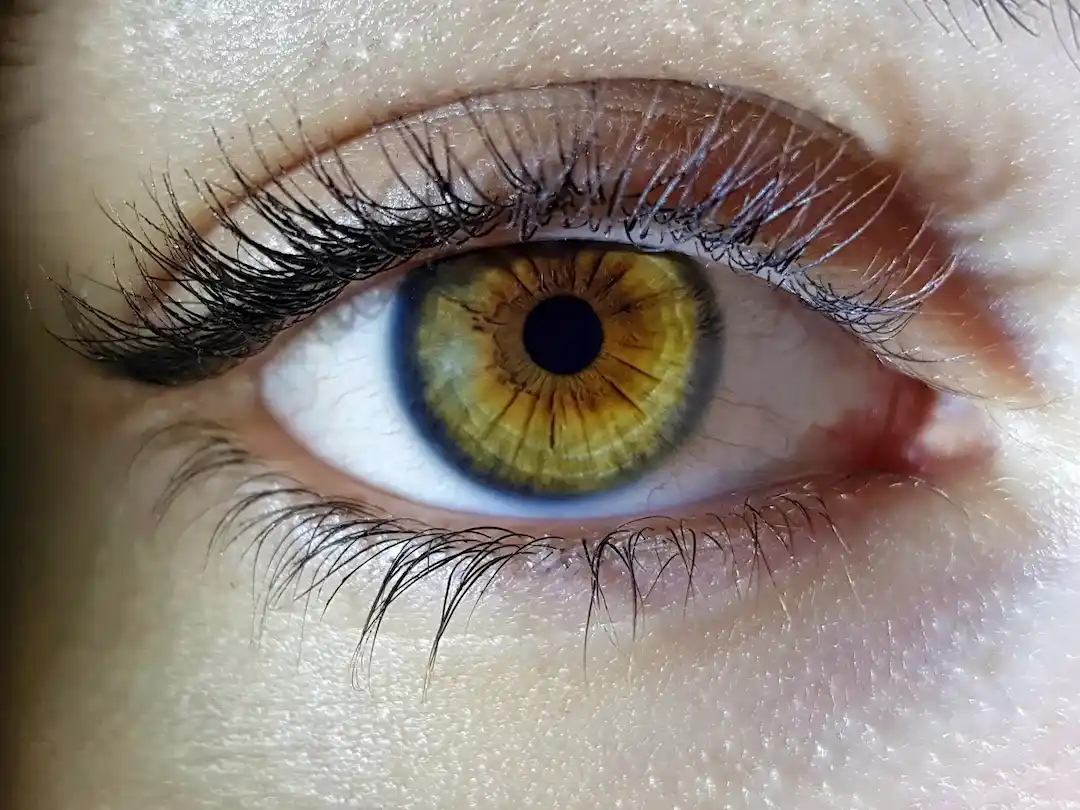 orzuelo en el ojo orzuelo en el ojo