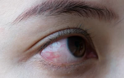 Escozor de ojos: causas más frecuentes y cómo aliviarlo